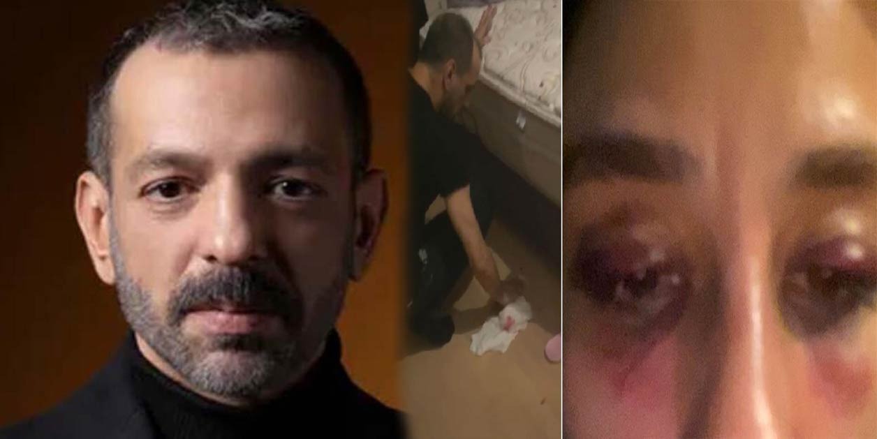 Rubato’nun solisti Özer Arkun’un sevgilisi darp iddiasıyla şikayetçi oldu